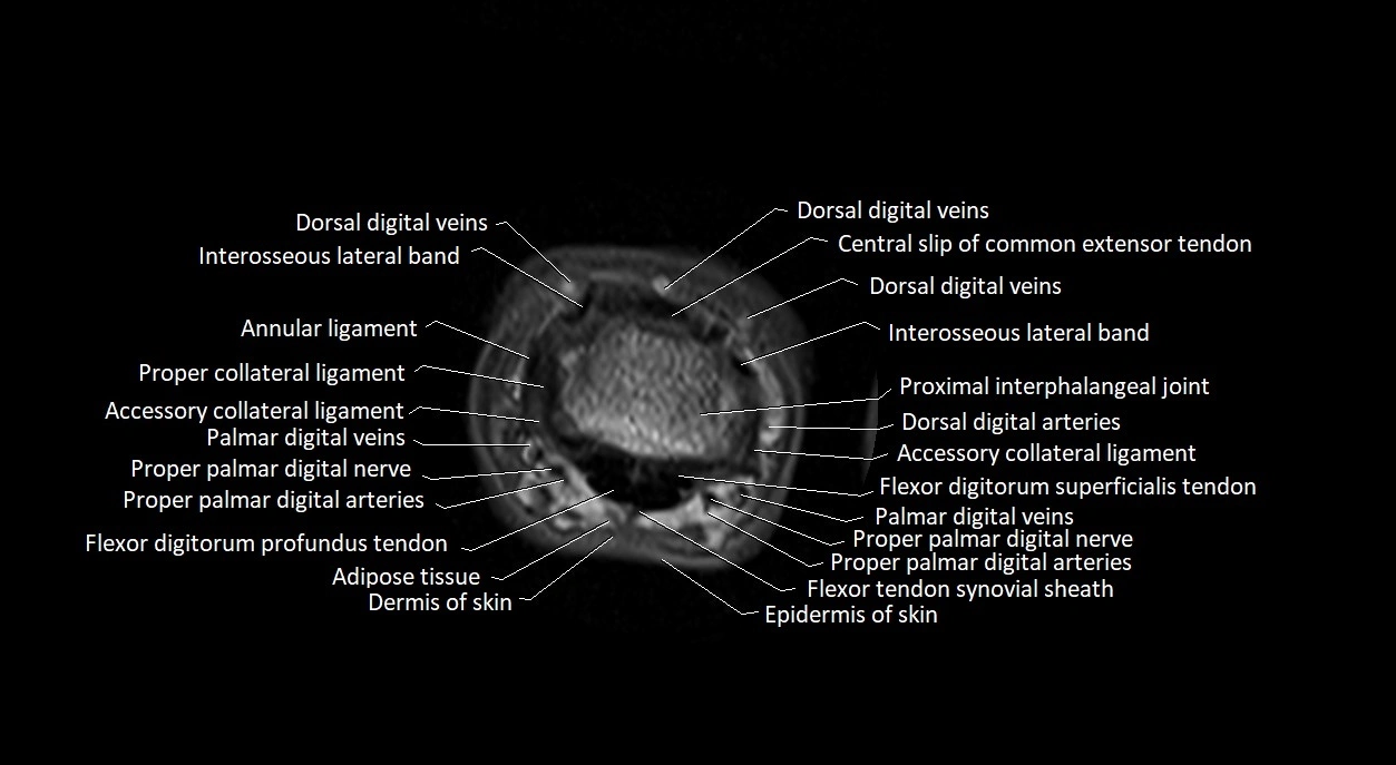 Finger anatomy axial cross sectional 3T image image 12.webp